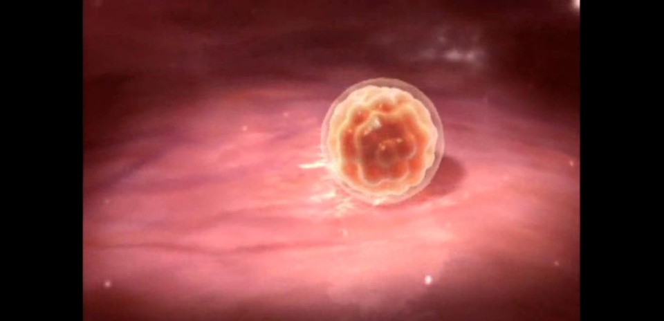 Blastocyst